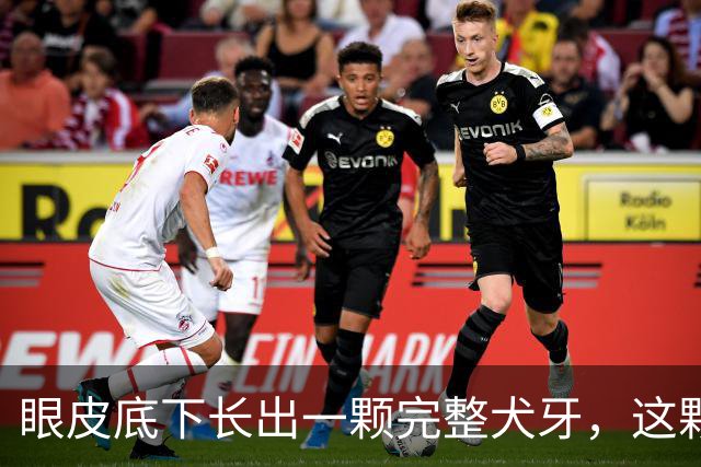 眼皮底下长出一颗完整犬牙，这颗牙到底是怎么“走错门”的？
